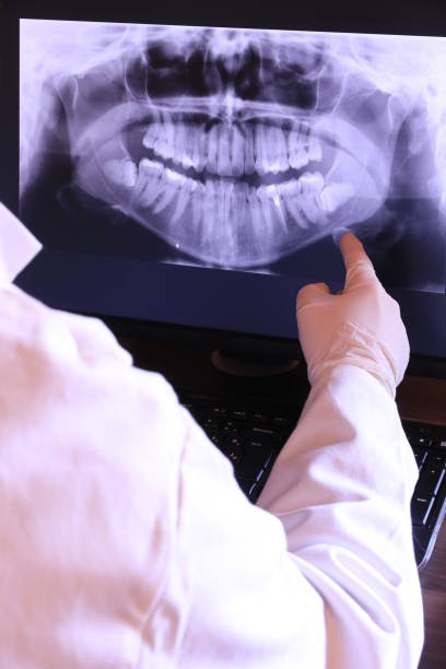 Best Dentist for Tooth Abscess  in Stevensville, MI