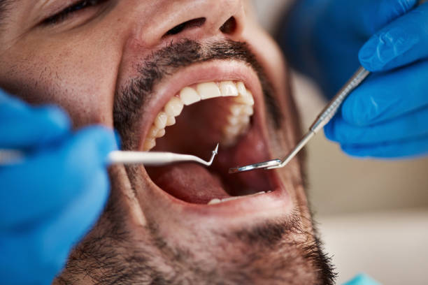 Best Same-Day Dentist Appointment  in Stevensville, MI